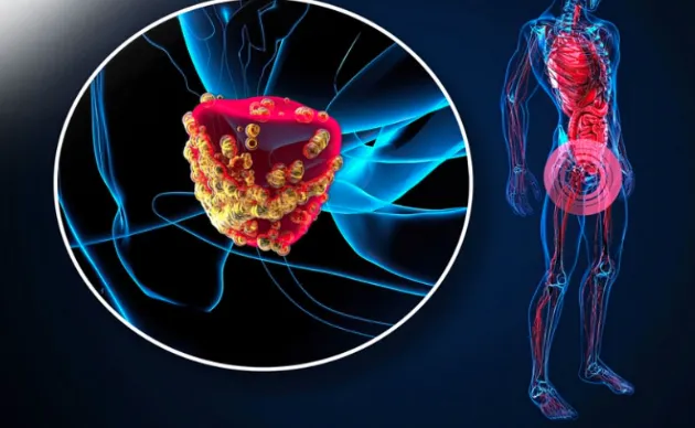cuoc-chien-voi-ung-thu-bang-quang-cua-bac-si-tran-bach-hoa-mot-cau-chuyen-hy-vong